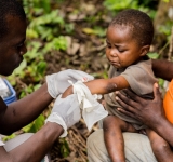 Lutte contre la variole simienne en Afrique : Les experts se mobilisent en RDC