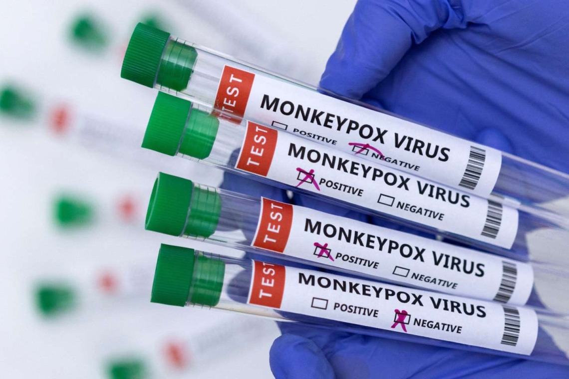 Etats-Unis : les cas contacts de Variole de singe vont être vaccinés pour prévenir la maladie