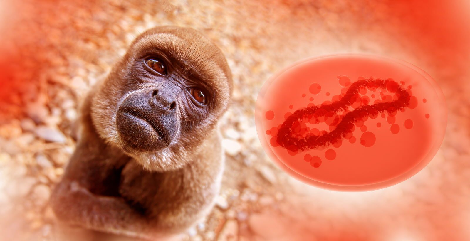 Premier décès lié au virus mpox, inquiétude sanitaire grandissante en Afrique de l’Ouest