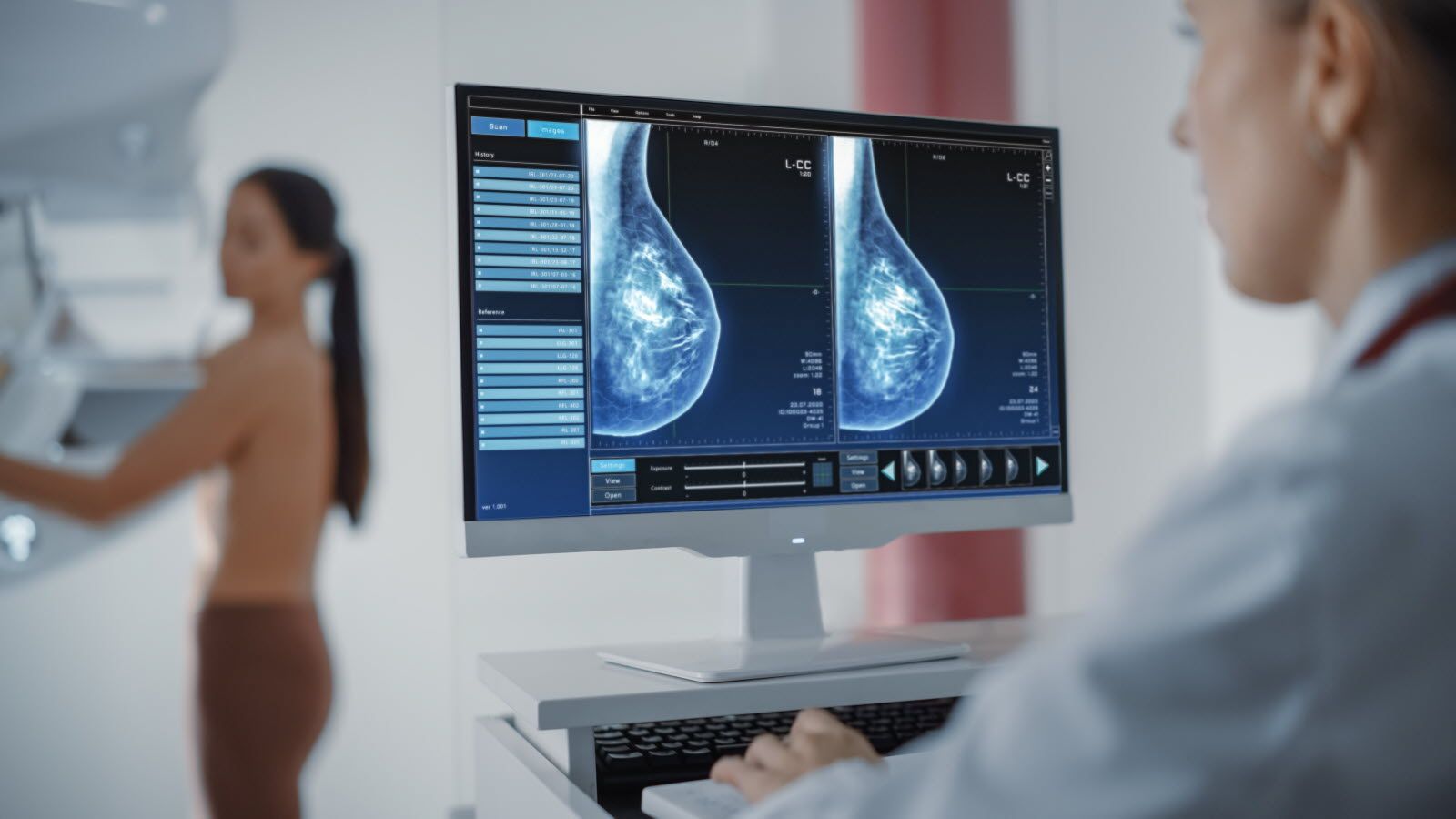 Lancement à Paris du grand réseau national d'imagerie médicale assistée par intelligence artificielle