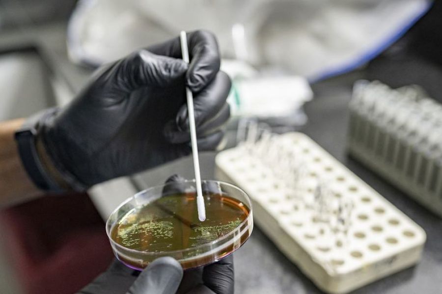 Le Retour aux Ténèbres Médicales : La Résistance aux Antimicrobiens, une Bombe à Retardement Stratégique