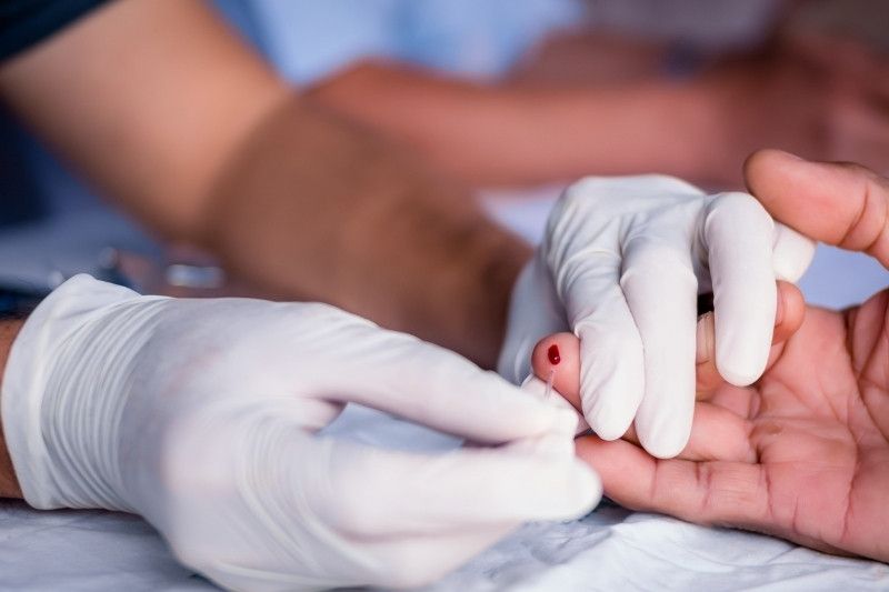 Cluster de VIH en Auvergne-Rhône-Alpes : Enjeux de santé publique