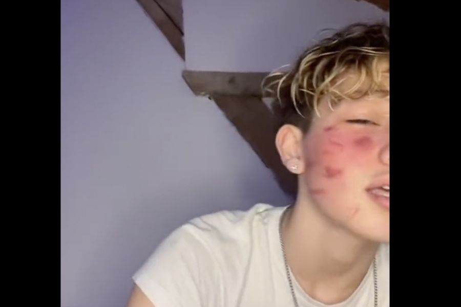 OMONDO SOCIÉTÉ - « C’est comme un jeu pour les filles de 9 à 17 ans » : au Kosovo, des familles accusent TikTok d'avoir poussé des adolescentes à s'auto-mutiler