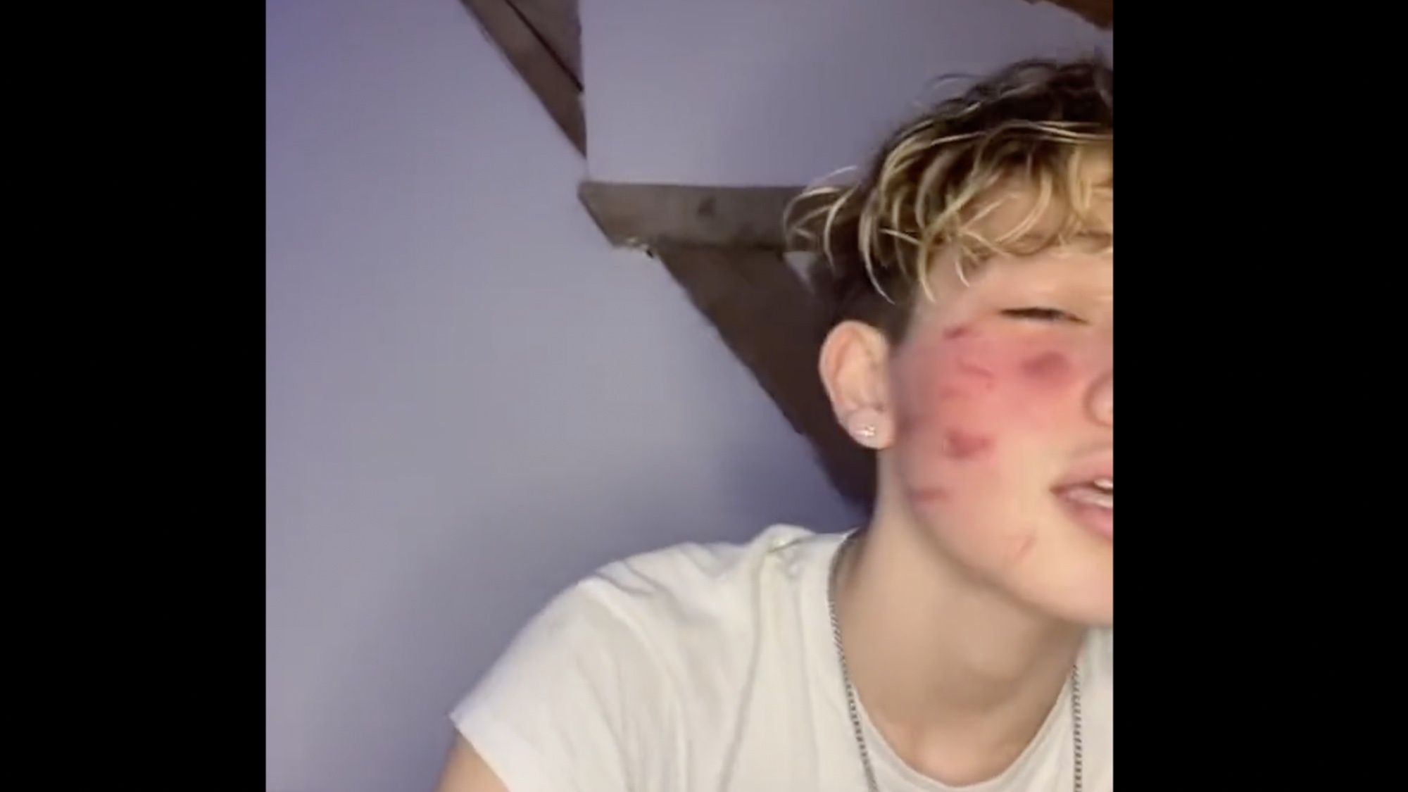 OMONDO SOCIÉTÉ - « C’est comme un jeu pour les filles de 9 à 17 ans » : au Kosovo, des familles accusent TikTok d'avoir poussé des adolescentes à s'auto-mutiler