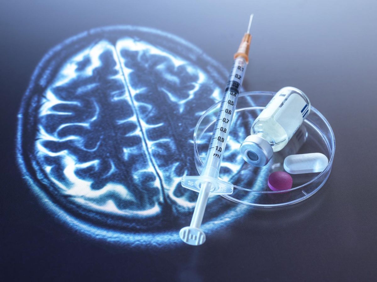 Nouveau Traitement Anti-Alzheimer 'Neuro-X' : Les Résultats de la Phase 3 Montrent 40% de Ralentissement de la Maladie